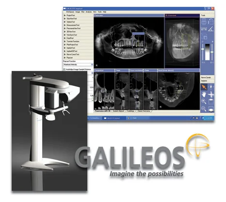 hoe to use galileos viewer software for implnat