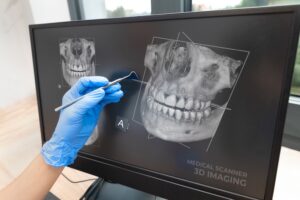 3D Dental Scan