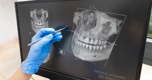 3D Dental Scan